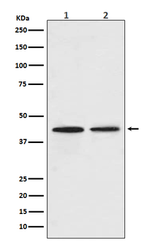 CCR9 Recombinant Rabbit Monoclonal Antibody
