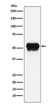 Fibrinogen gamma chain Recombinant Rabbit Monoclonal Antibody
