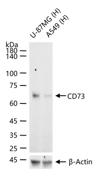 CD73 Recombinant Rabbit Monoclonal Antibody