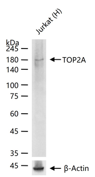 TOP2A Recombinant Rabbit Monoclonal Antibody
