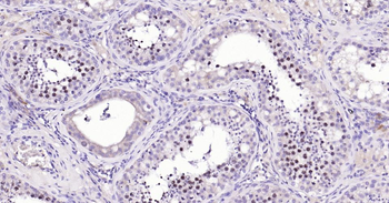 TOP2A Recombinant Rabbit Monoclonal Antibody