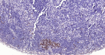 TOP2A Recombinant Rabbit Monoclonal Antibody