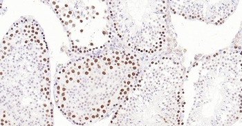 TOP2A Recombinant Rabbit Monoclonal Antibody