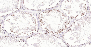TOP2A Recombinant Rabbit Monoclonal Antibody