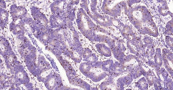 CD8 Recombinant Rabbit Monoclonal Antibody