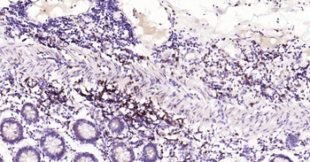 CD8 Recombinant Rabbit Monoclonal Antibody