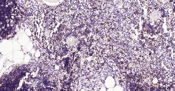 CD8 Recombinant Rabbit Monoclonal Antibody