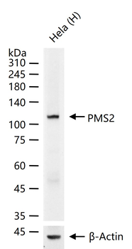 PMS2 Recombinant Rabbit Monoclonal Antibody