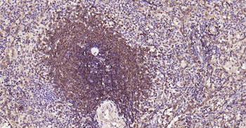 Bcl-2 Recombinant Rabbit Monoclonal Antibody