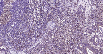 Caspase-3 Recombinant Rabbit Monoclonal Antibody