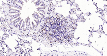 Caspase-3 Recombinant Rabbit Monoclonal Antibody