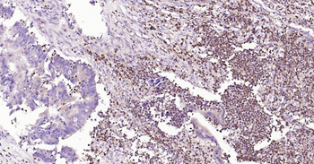 Arginase 1 Mouse Monoclonal Antibody