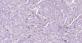 Arginase 1 Mouse Monoclonal Antibody