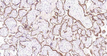 PAPPA Mouse Monoclonal Antibody