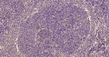 PIK3R3 Recombinant Rabbit Monoclonal Antibody