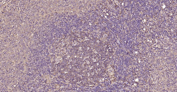 PIK3R3 Recombinant Rabbit Monoclonal Antibody