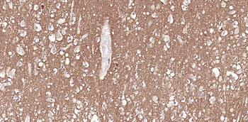 Tau-4 Mouse Monoclonal Antibody