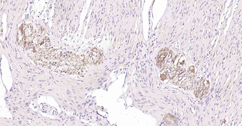Tau-4 Mouse Monoclonal Antibody