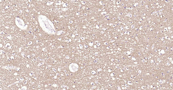 Tau-4 Mouse Monoclonal Antibody