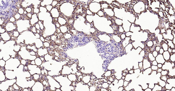 Tau-4 Mouse Monoclonal Antibody