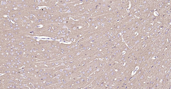 Tau-4 Mouse Monoclonal Antibody