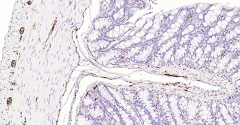 Tau-4 Mouse Monoclonal Antibody