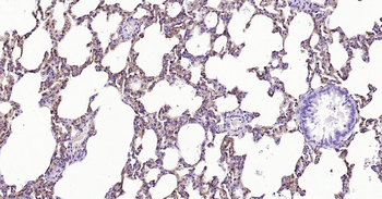 Tau-4 Mouse Monoclonal Antibody