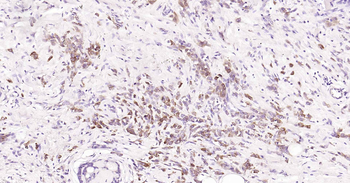 Tau-4 Mouse Monoclonal Antibody