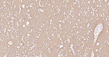 Tau-4 Mouse Monoclonal Antibody