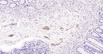 Tau-4 Mouse Monoclonal Antibody