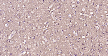 Tau-4 Mouse Monoclonal Antibody