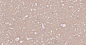 ATP1B1 Recombinant Rabbit Monoclonal Antibody