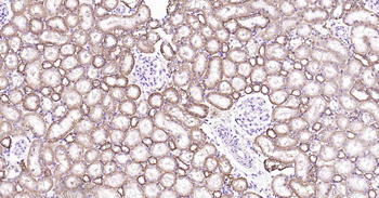 ATP1B1 Recombinant Rabbit Monoclonal Antibody