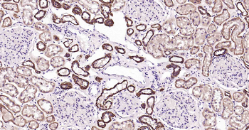 ATP1B1 Recombinant Rabbit Monoclonal Antibody