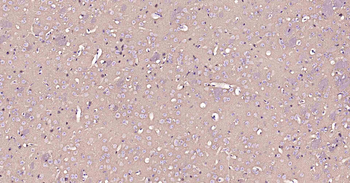 ATP1B1 Recombinant Rabbit Monoclonal Antibody