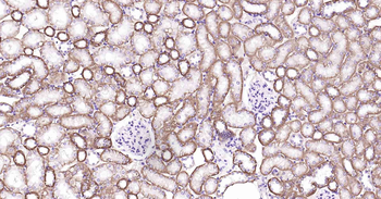 ATP1B1 Recombinant Rabbit Monoclonal Antibody