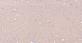 ATP1B1 Recombinant Rabbit Monoclonal Antibody