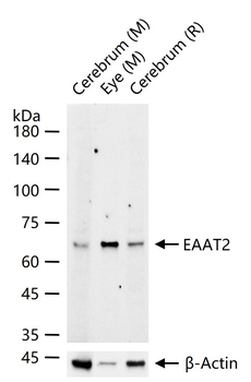 EAAT2 Recombinant Rabbit Monoclonal Antibody