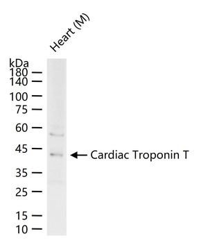 Cardiac Troponin T Rabbit Polyclonal Antibody