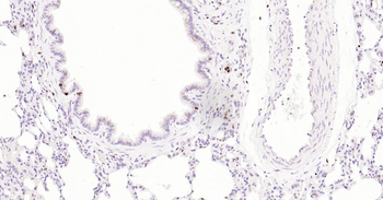 5 Lipoxygenase Recombinant Rabbit Monoclonal Antibody