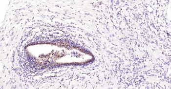 5 Lipoxygenase Recombinant Rabbit Monoclonal Antibody