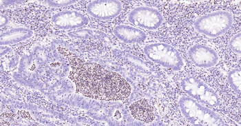 5 Lipoxygenase Recombinant Rabbit Monoclonal Antibody