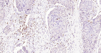 5 Lipoxygenase Recombinant Rabbit Monoclonal Antibody