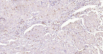 5 Lipoxygenase Recombinant Rabbit Monoclonal Antibody