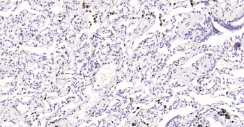 5 Lipoxygenase Recombinant Rabbit Monoclonal Antibody