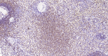 5 Lipoxygenase Recombinant Rabbit Monoclonal Antibody