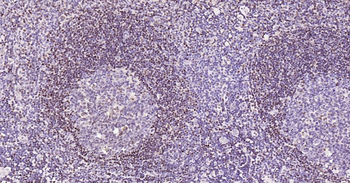 5 Lipoxygenase Recombinant Rabbit Monoclonal Antibody