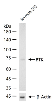 BTK Recombinant Rabbit Monoclonal Antibody