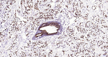 Frizzled 8 Recombinant Rabbit Monoclonal Antibody