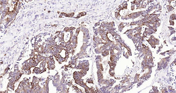 Frizzled 8 Recombinant Rabbit Monoclonal Antibody